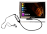 Archos FM Remote pour Archos 5 et 7