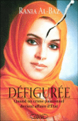 Défigurée&nbsp;-&nbsp;Rania Al-Baz
