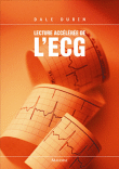 Lecture acc�l�r�e de l'ECG
